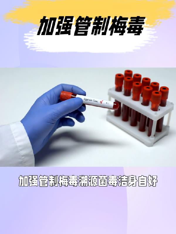 加强廉洁自律筑牢拒腐防线